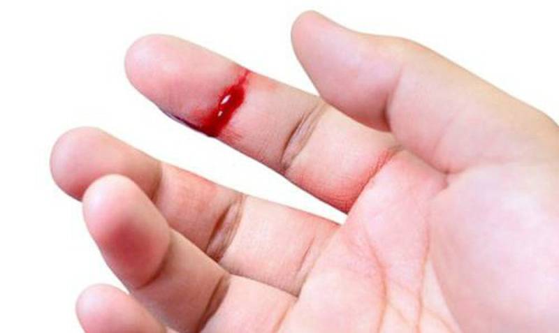 Mơ thấy ngón tay bị đứt