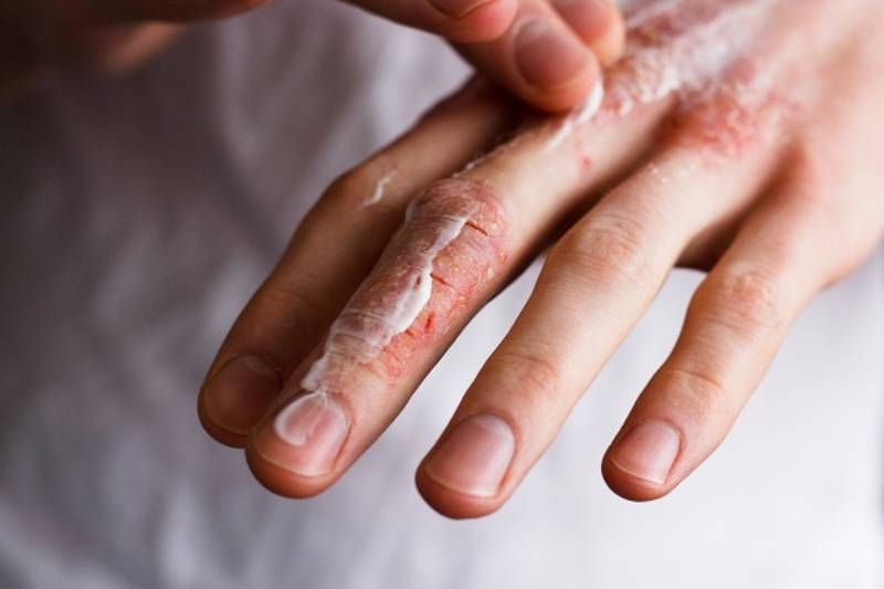 Mơ thấy tay bị đứt khi làm việc